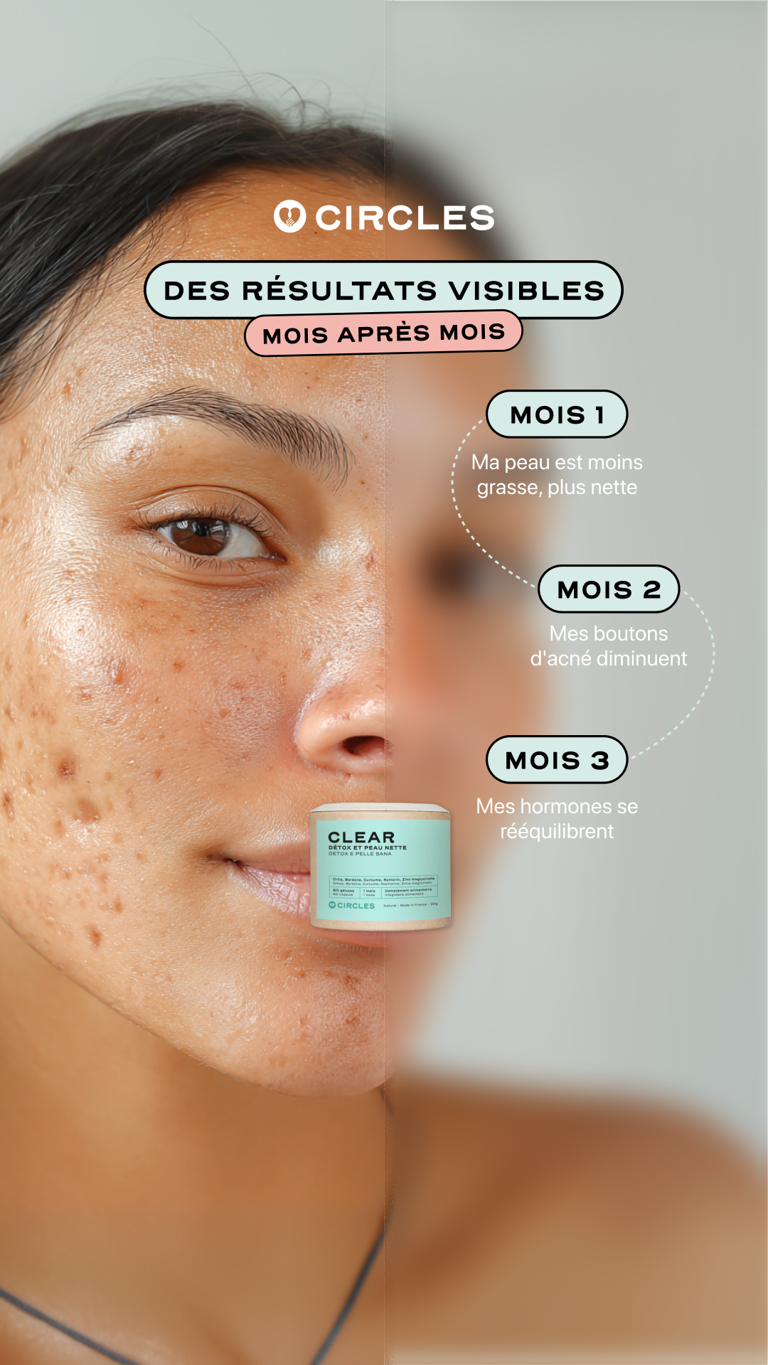 Circles Facebook ad: CLEAR, cure de 3 mois