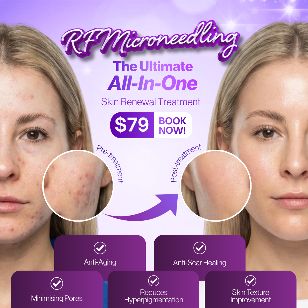 Love My Skin Treatments Facebook ad