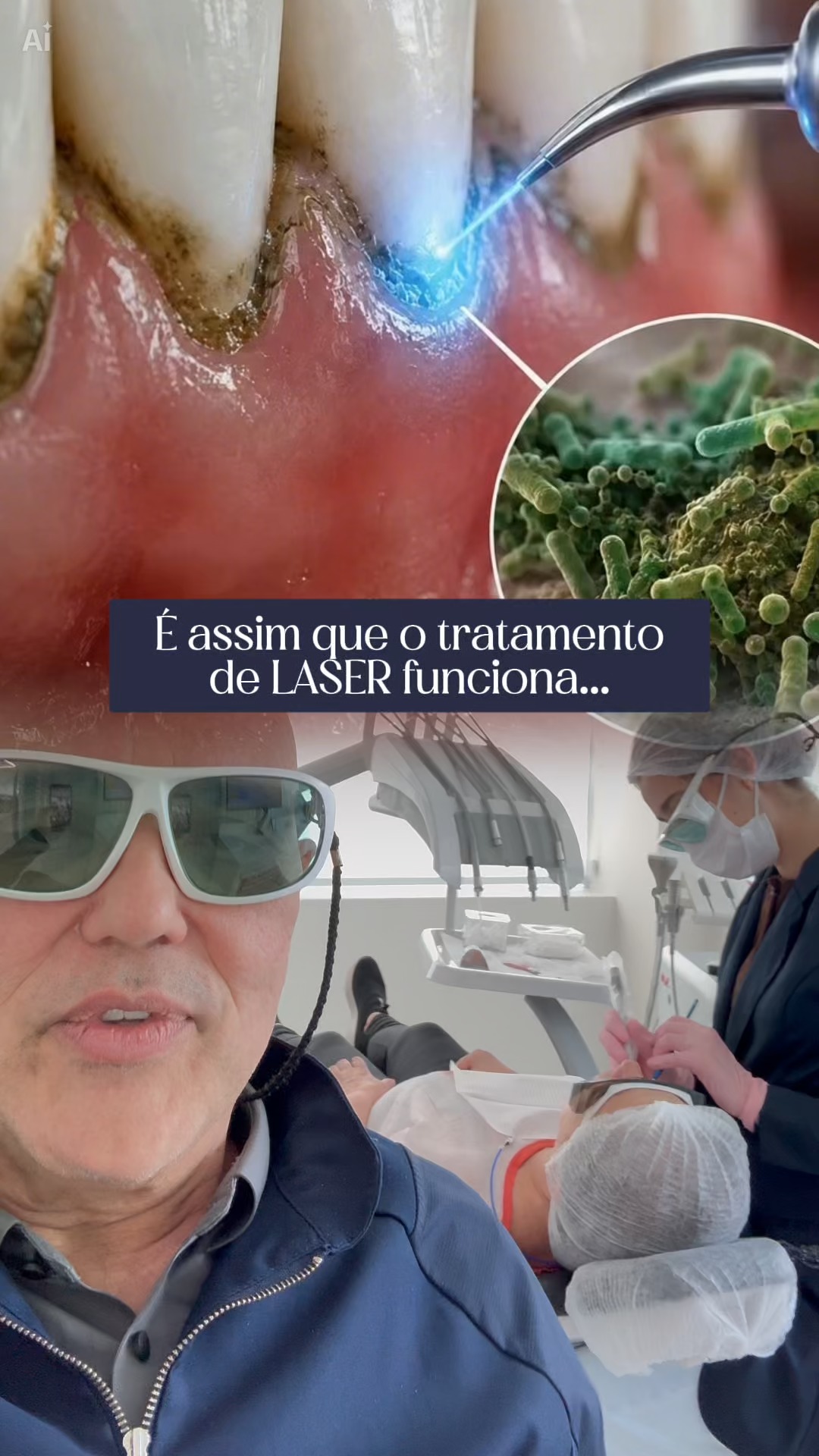 Fernando Costa Jr Facebook ad: É assim que funciona o tratamento com laser