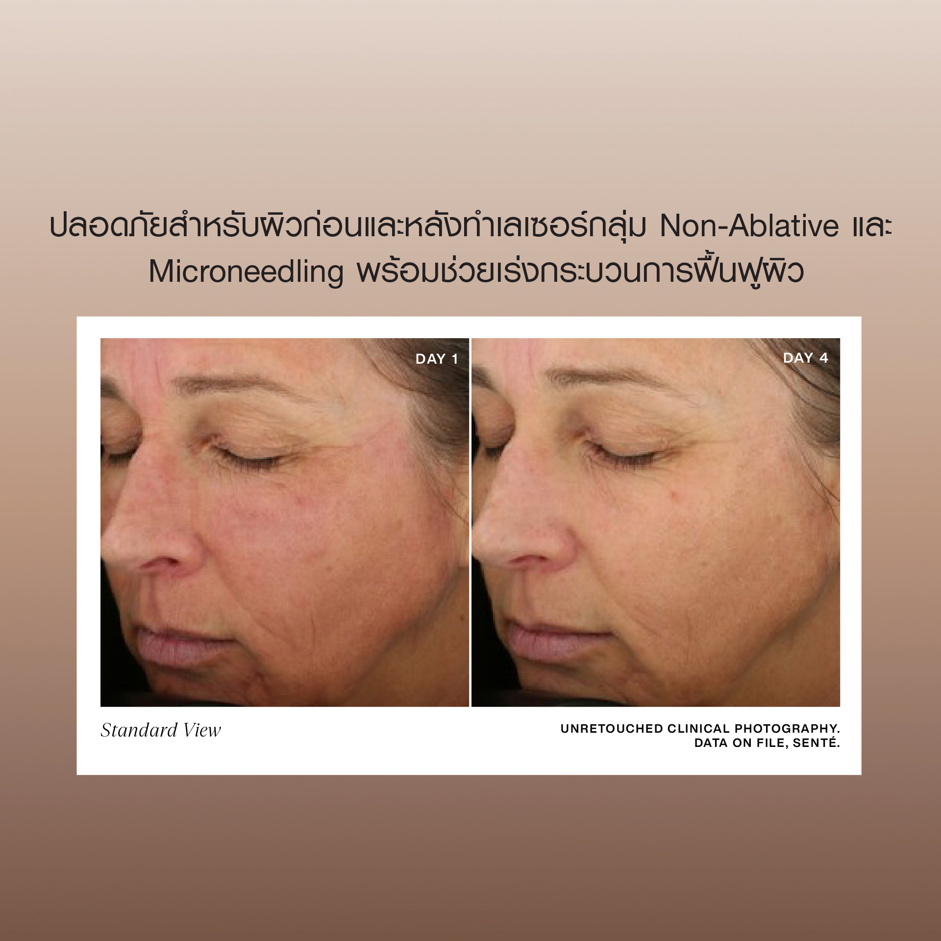 Sente Thailand Facebook ad: ผลิตภัณฑ์ Medical Grade Skincare จากอเมริกา