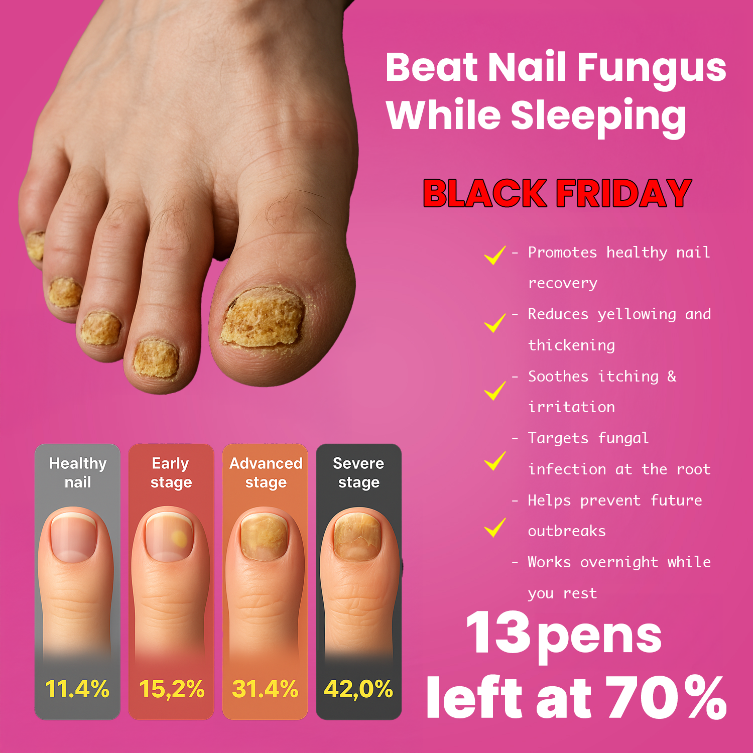 Naturry Facebook ad: Say Goodbye to Toenail Fungus