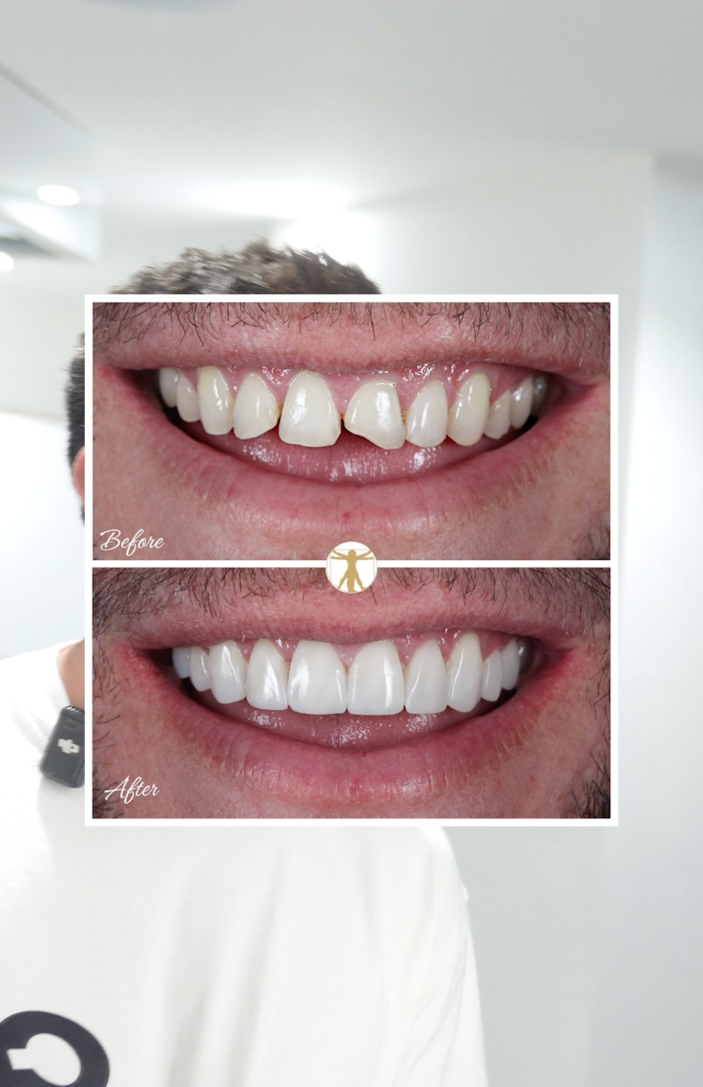Vitruvian Cosmetic Dentistry and Implant Studio Facebook ad: Click to take the first step towards your dream smile