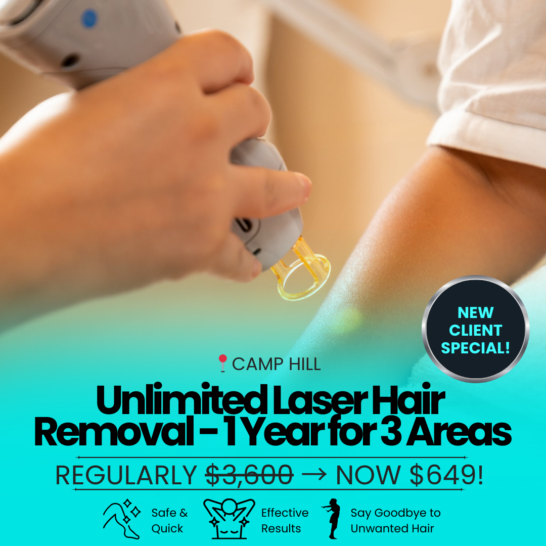 Sculpt PA Facebook ad: Unlimited Laser Hair Removal for 1 Year NOW $649!