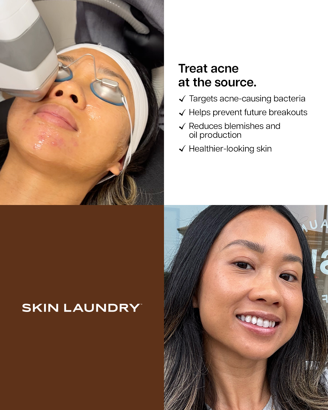 Skin Laundry Facebook ad