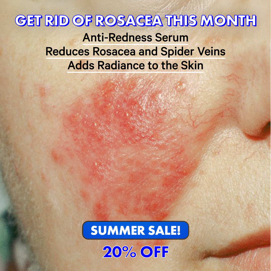 Anti-Redness US Facebook ad