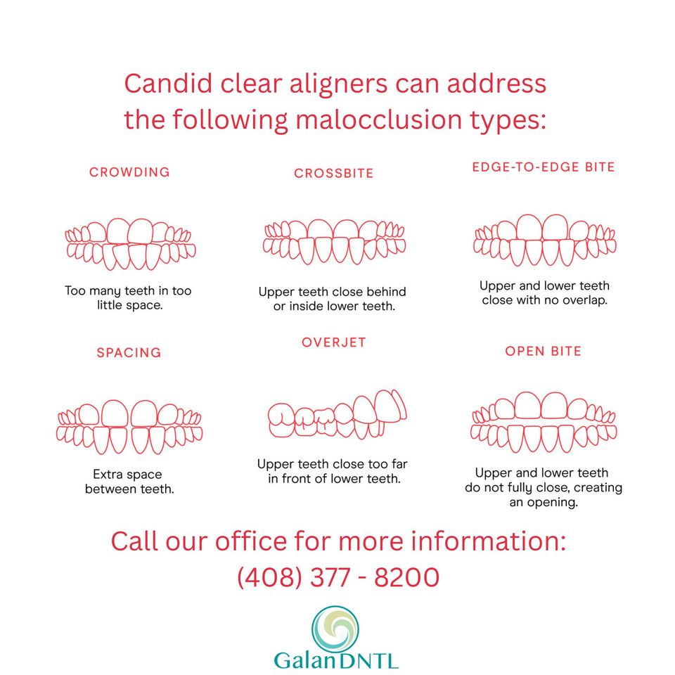 Galan Dental Facebook ad: Emergency Dentist San Jose CA - Holistic Dentistry &…