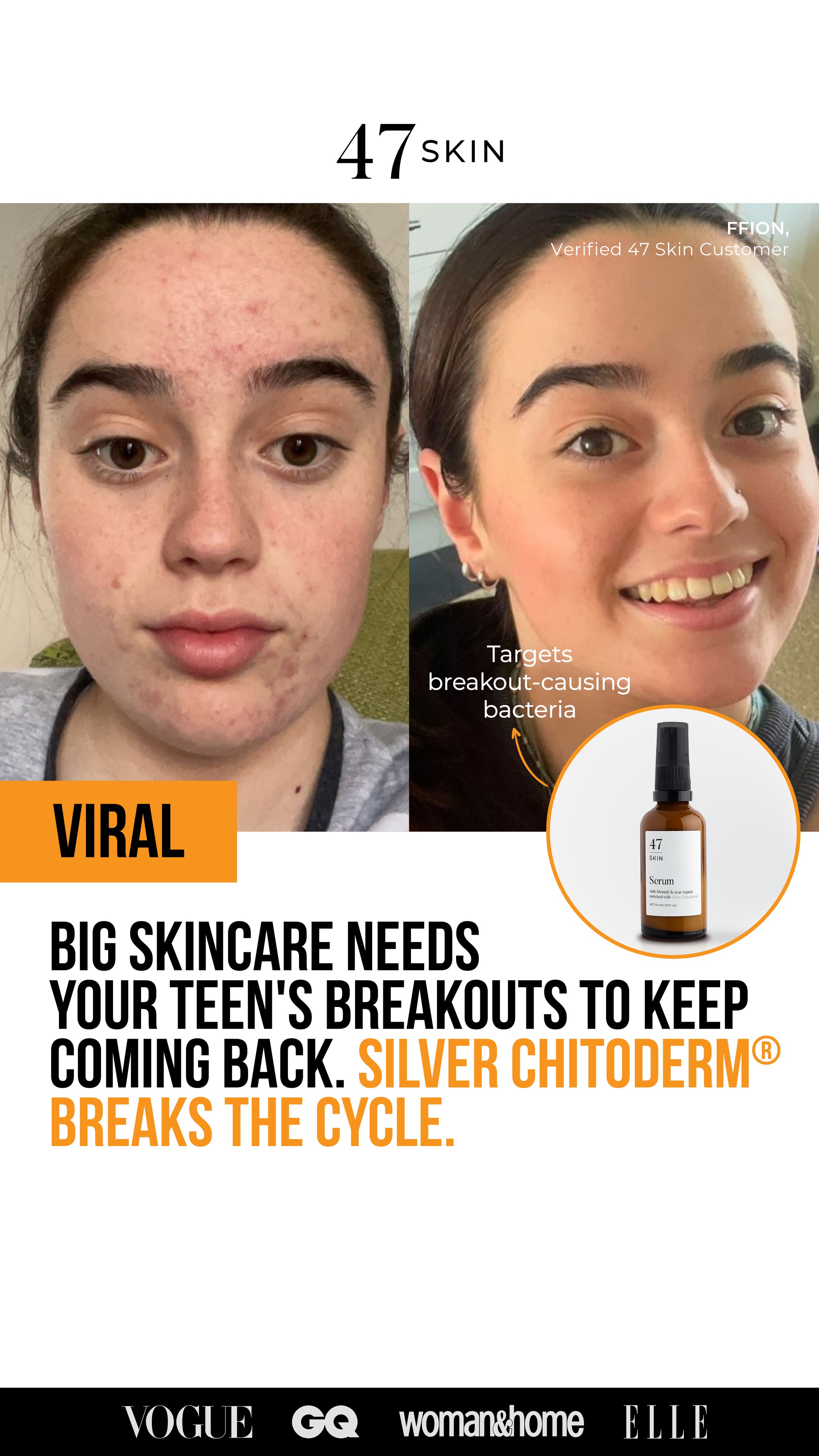 47Skin Facebook ad