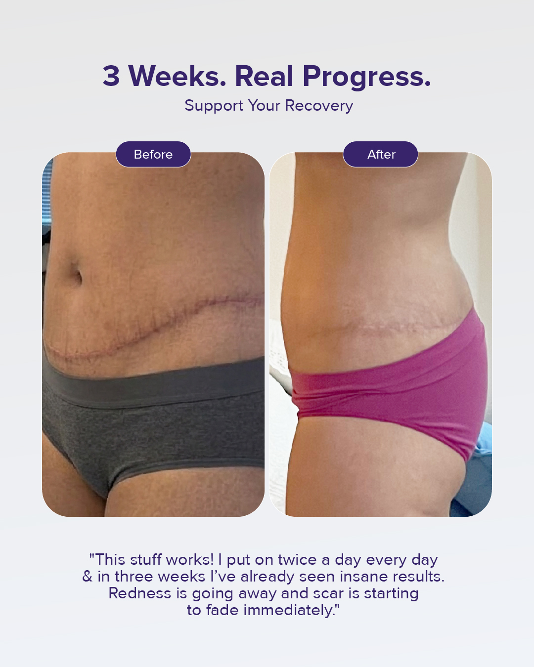 BIOCORNEUM + Facebook ad