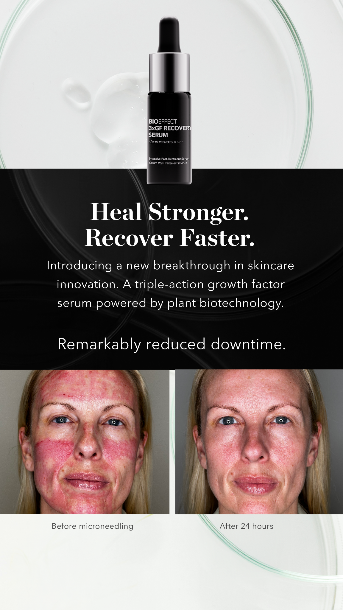 BIOEFFECT Facebook ad