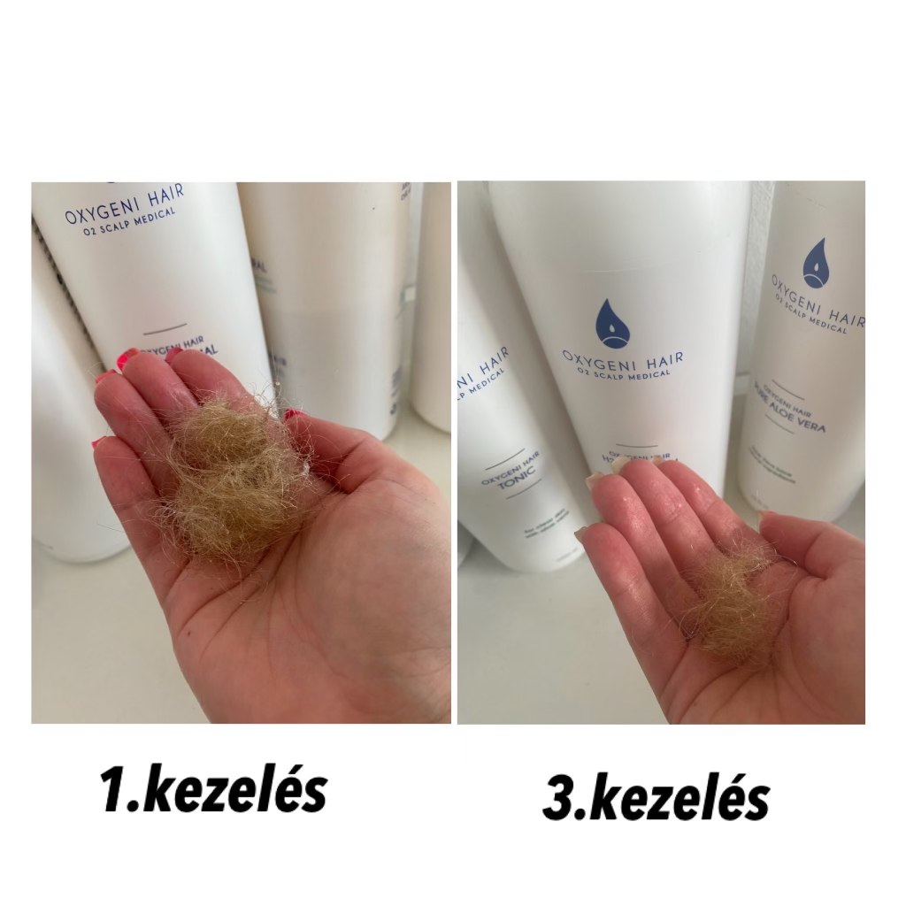 Oxygeni Hair & Skin Hajgyógyász és Bőrterápia Szalon Győr Facebook ad