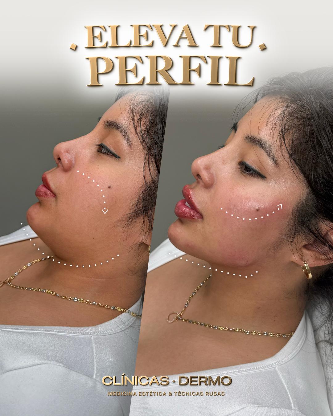 Dermo Clinic Chorbadzhyiiska Facebook ad
