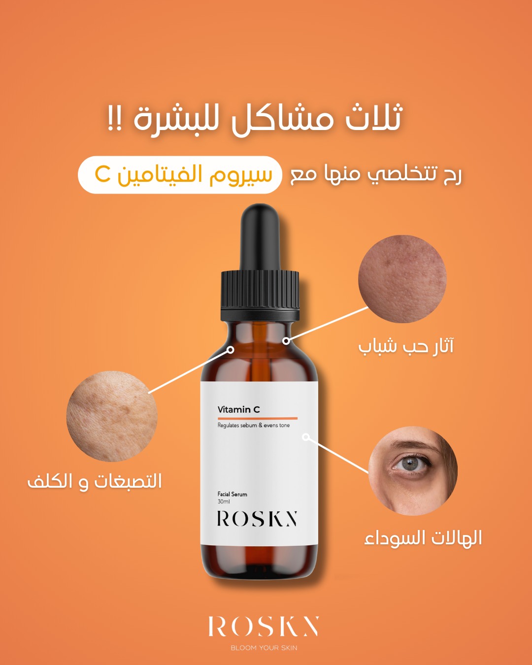 ROSKN Facebook ad