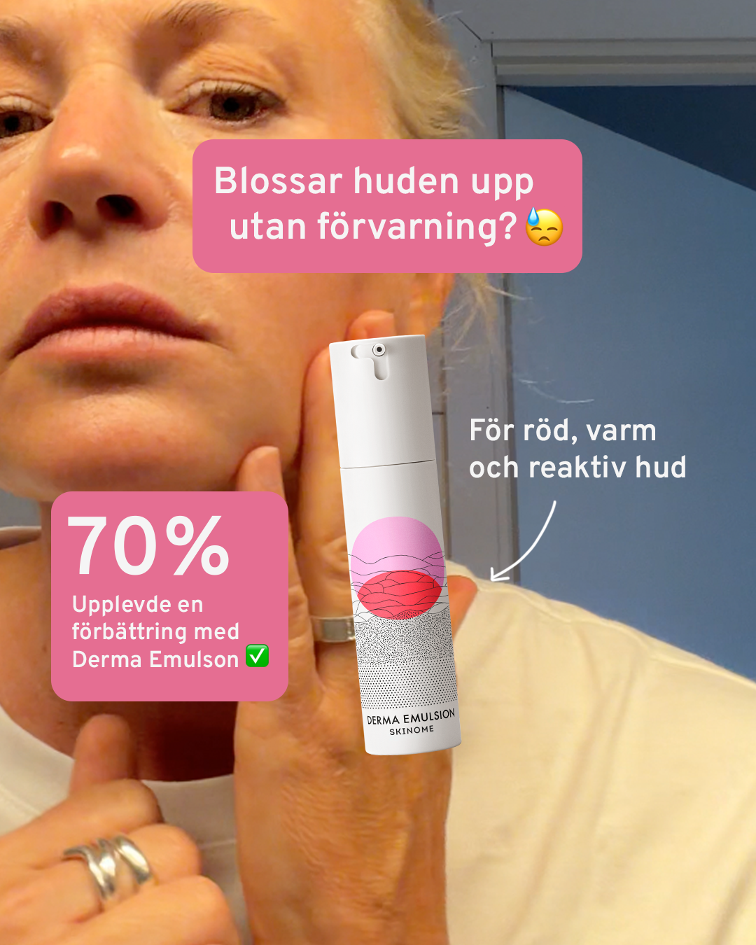 Skinome Facebook ad