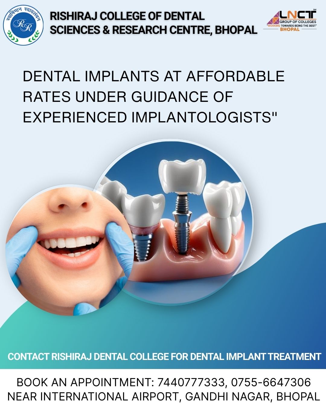 Rishiraj College of Dental Sciences and Research Centre, Bhopal Facebook ad: Affordable Dental Implants - RCDS