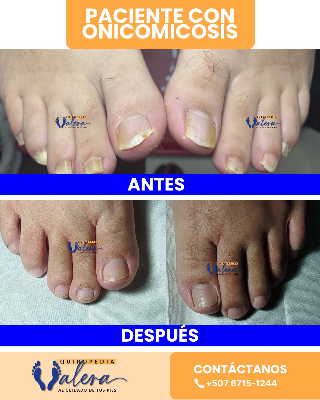 Quiropedia Andrés Valera Facebook ad