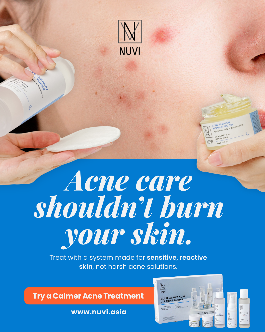 NUVI Facebook ad: Stop Breakouts Before They Spread!