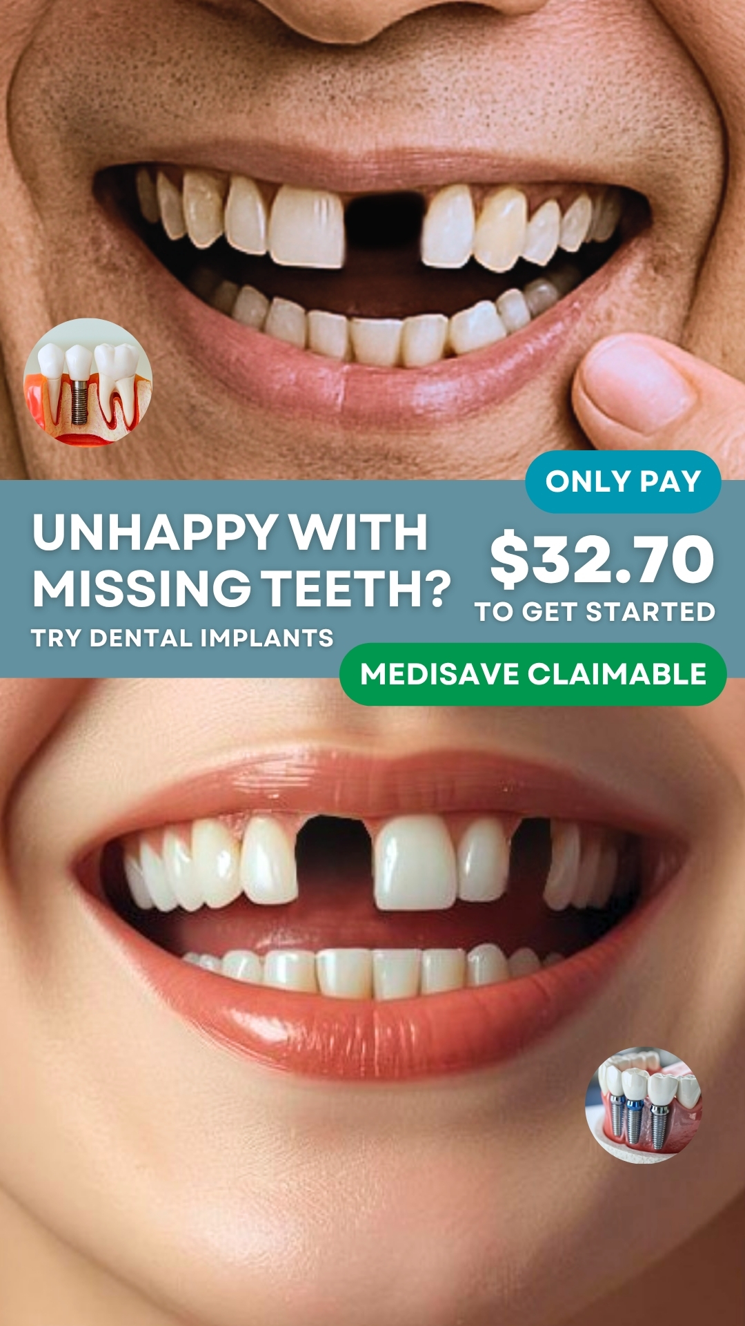 NoFrills Dental Facebook ad from Mar 21, 2026