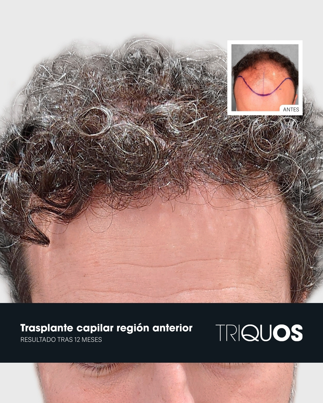 Triquos Medical Facebook ad: ¿Y si pudieras poner el tiempo a tu…