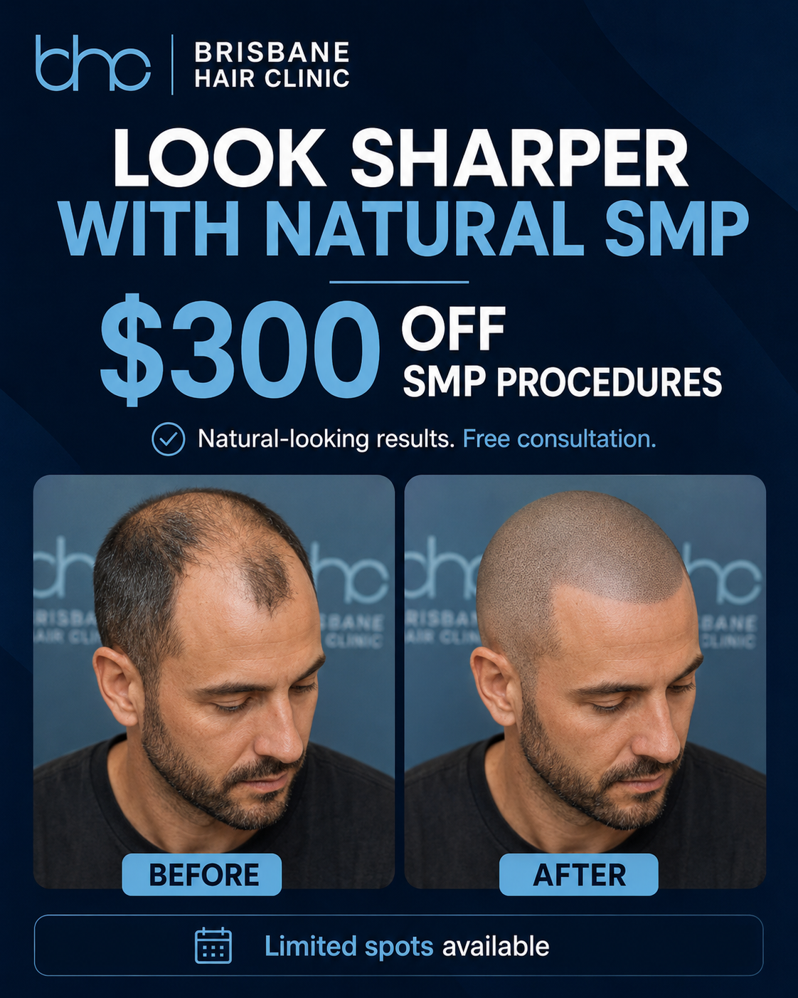Brisbane Hair Clinic Facebook ad from Jun 16, 2026