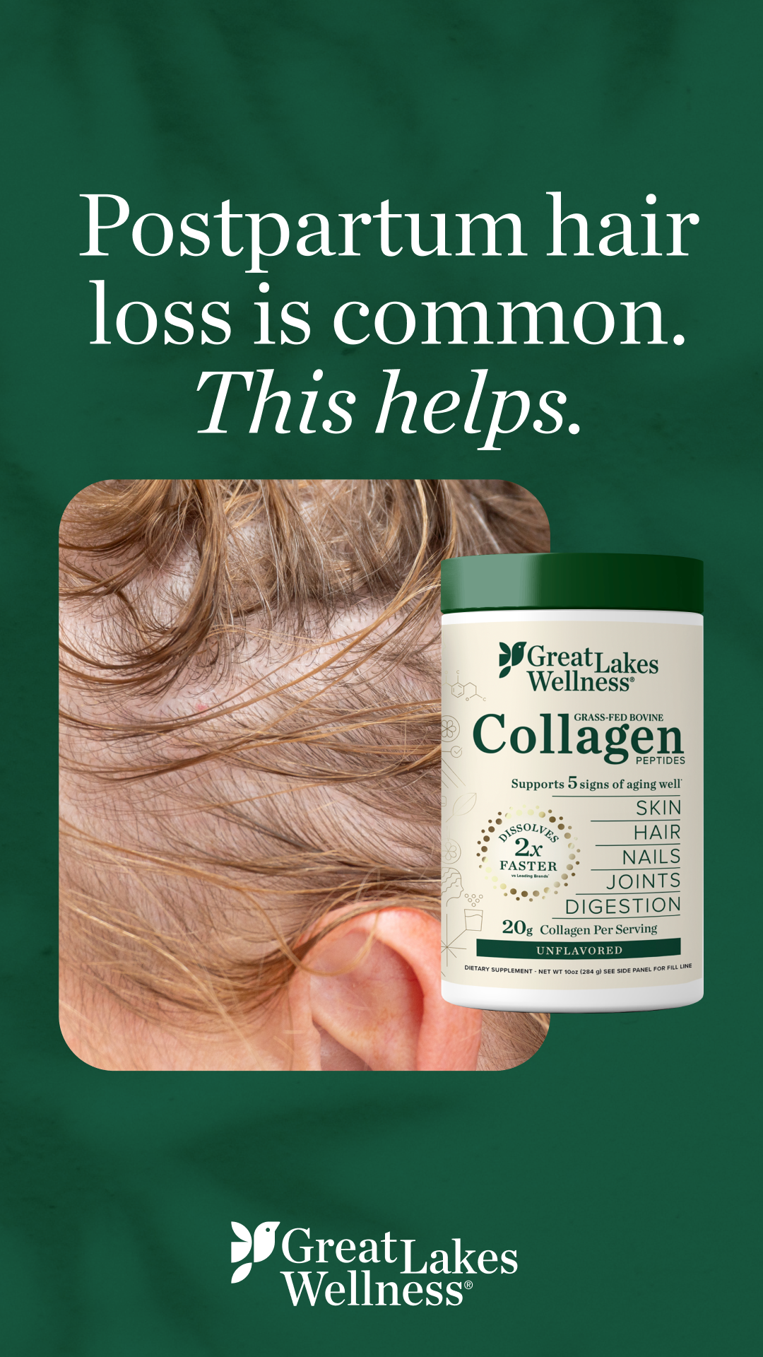Great Lakes Wellness Facebook ad from Feb 4, 2026