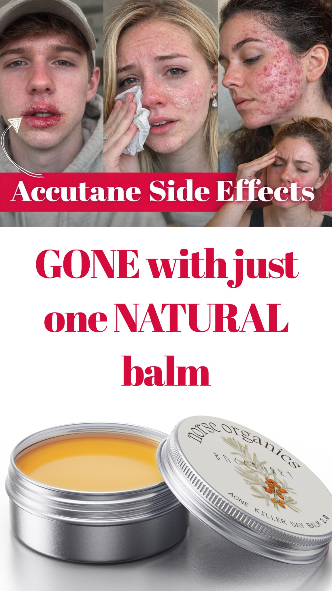 Anne's Skincare Blog Facebook ad
