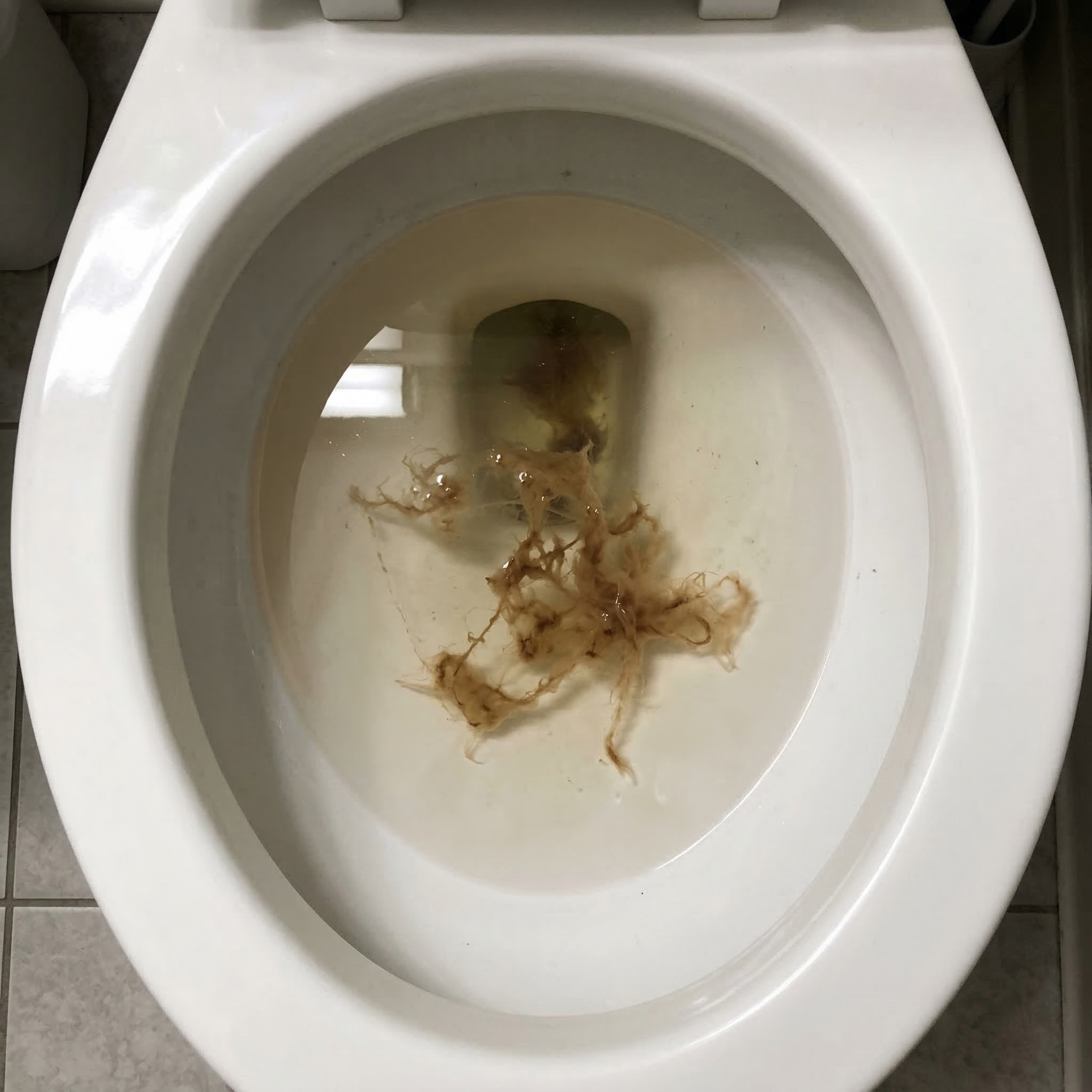Bruce Martin Facebook ad: I spent $4,300 on IBS. Here’s what actually fixed it.