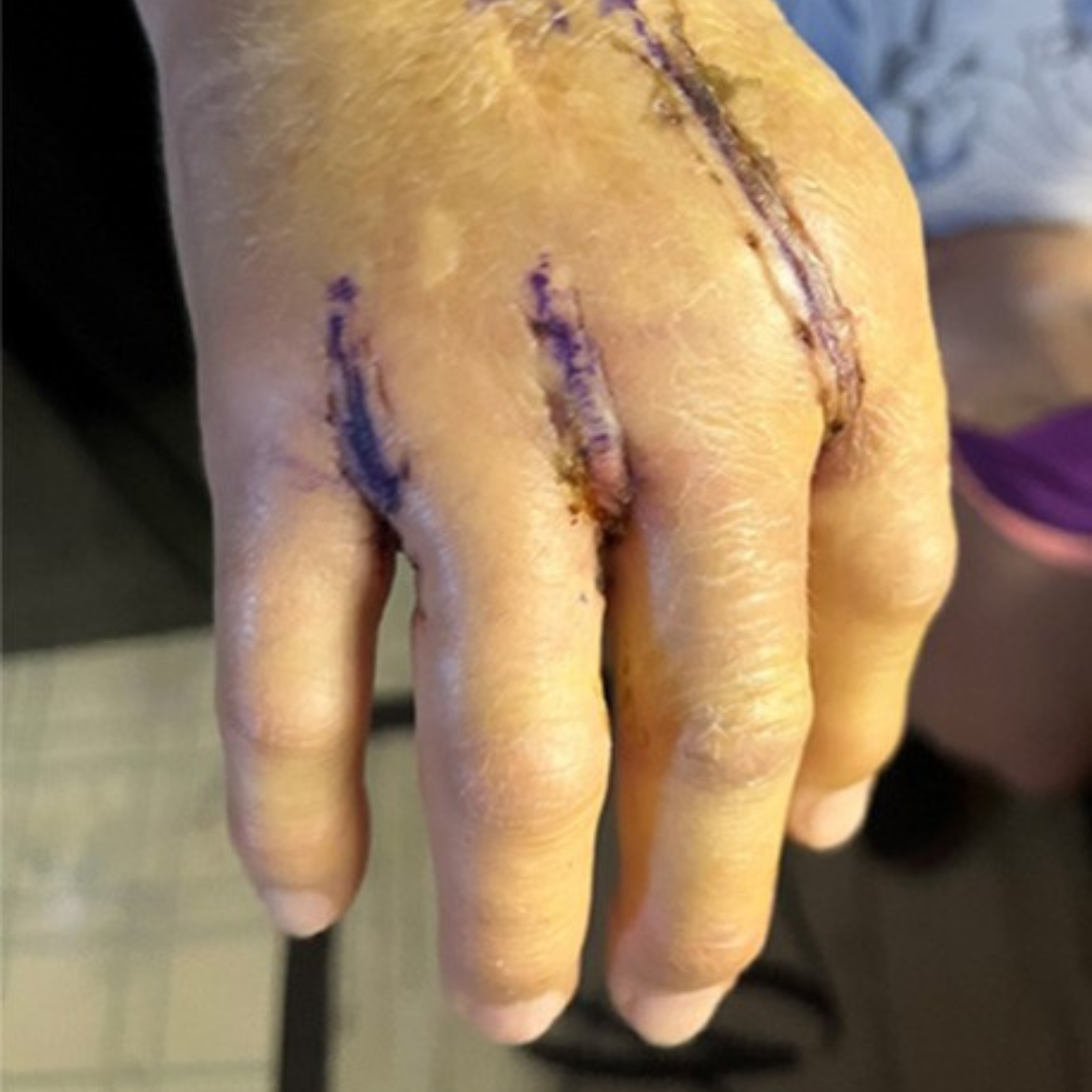 Relief Science Journal Facebook ad: Read If You Have Arthritis In Your Hands