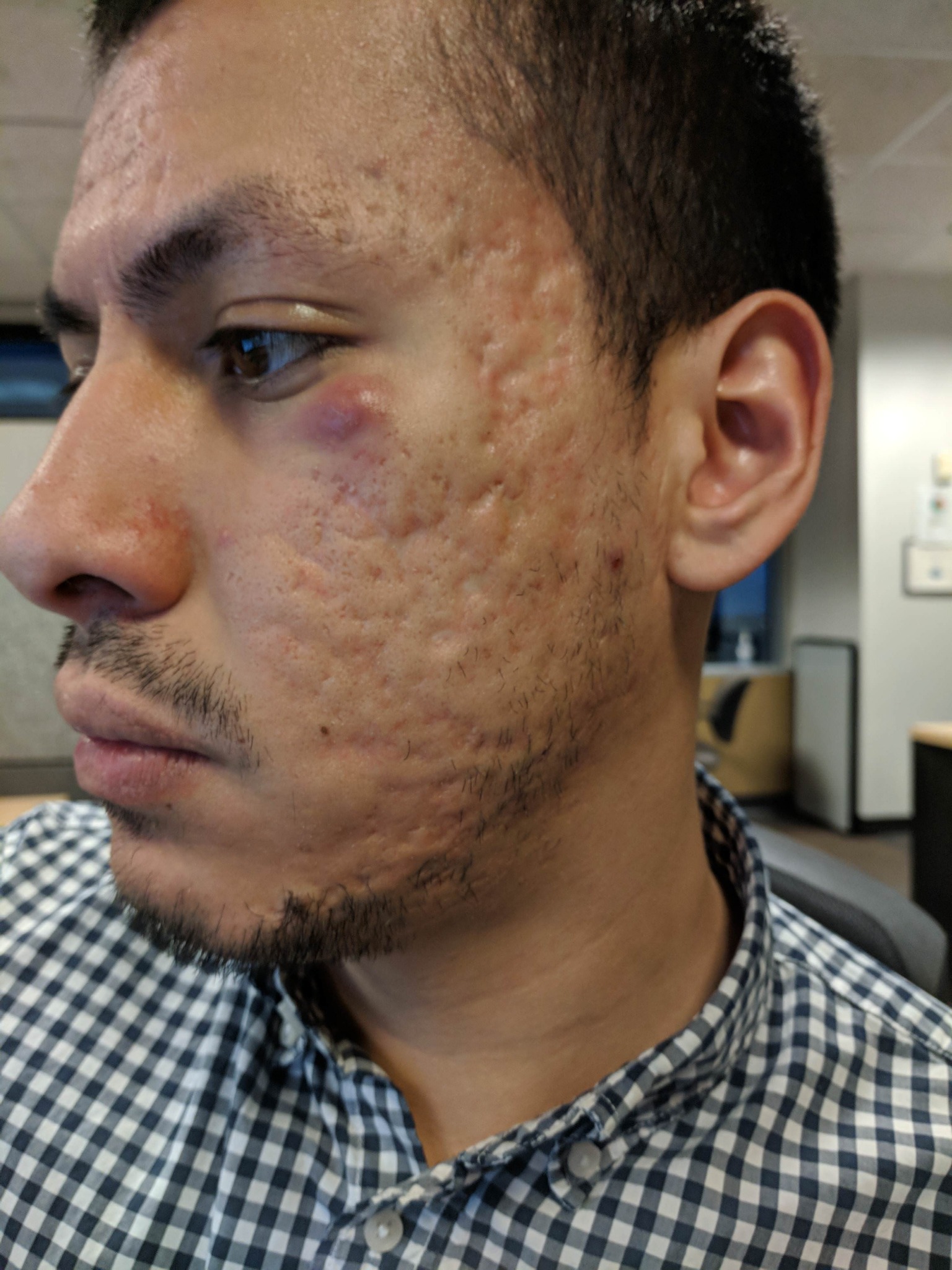 The Skin Collective Facebook ad: Read this to get rid of SCARS