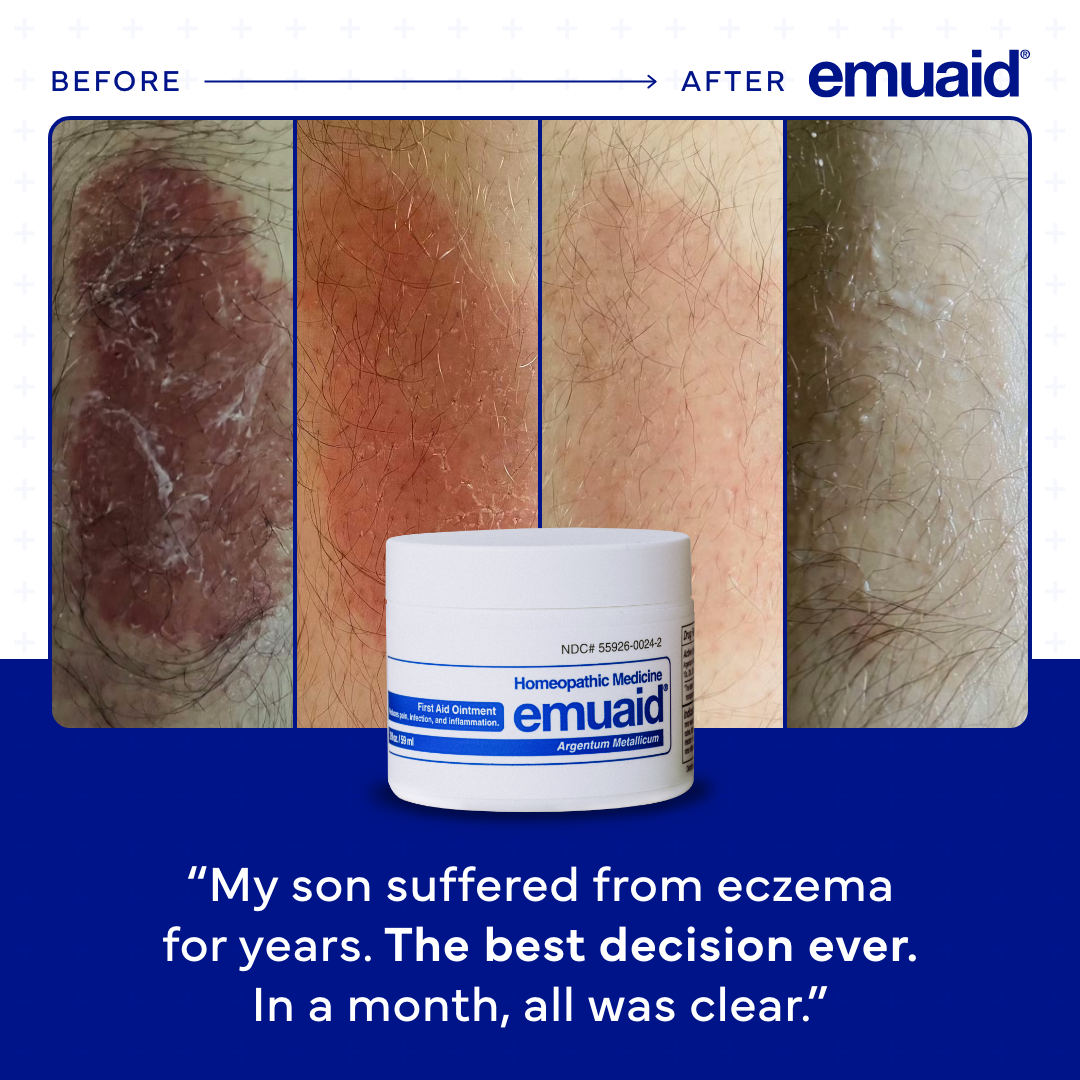 Emuaid Facebook ad