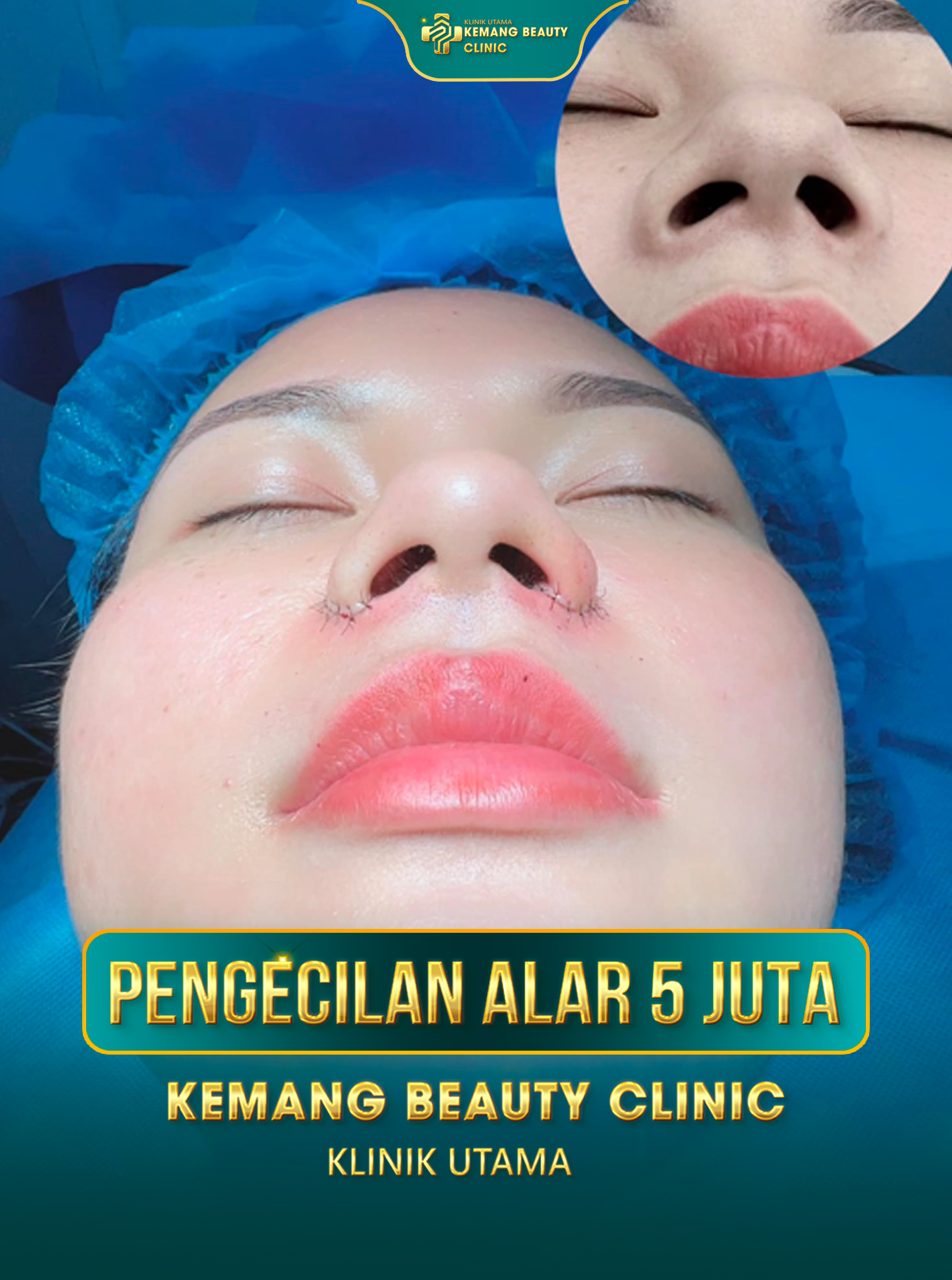 Kemang Beauty Clinic688 Facebook ad