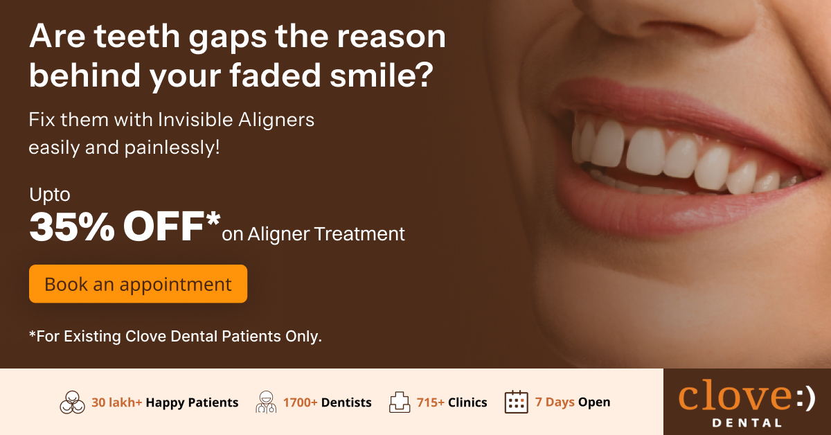 Clove Dental Facebook ad