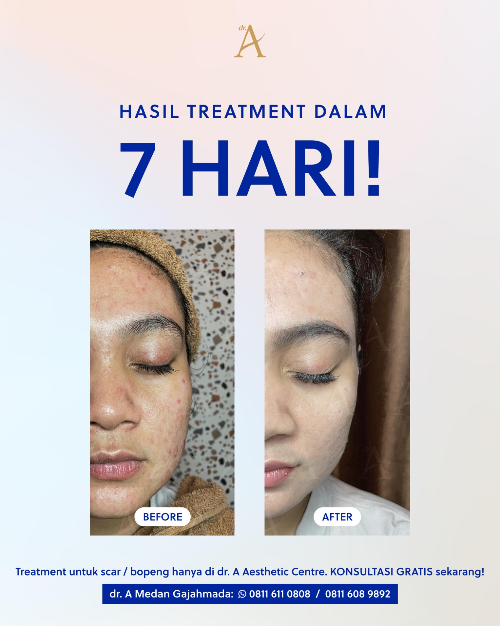 Dr. A Aesthetic Centre Facebook ad