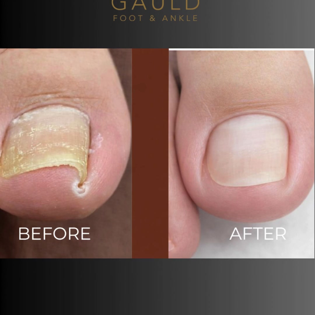 Gauld Foot & Ankle Facebook ad: Book an appointment