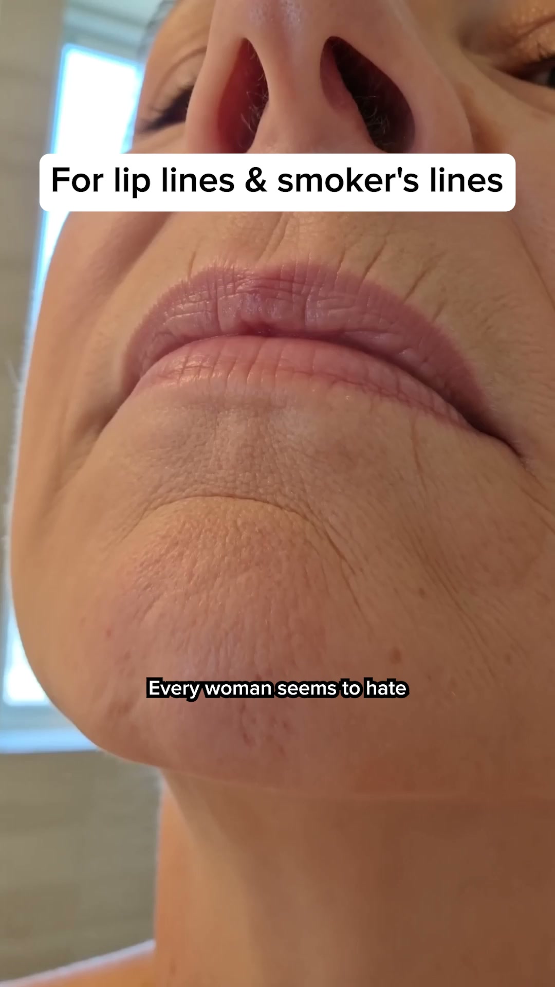 Based Supplies Facebook ad: Restore Your Skin in 3 Weeks!