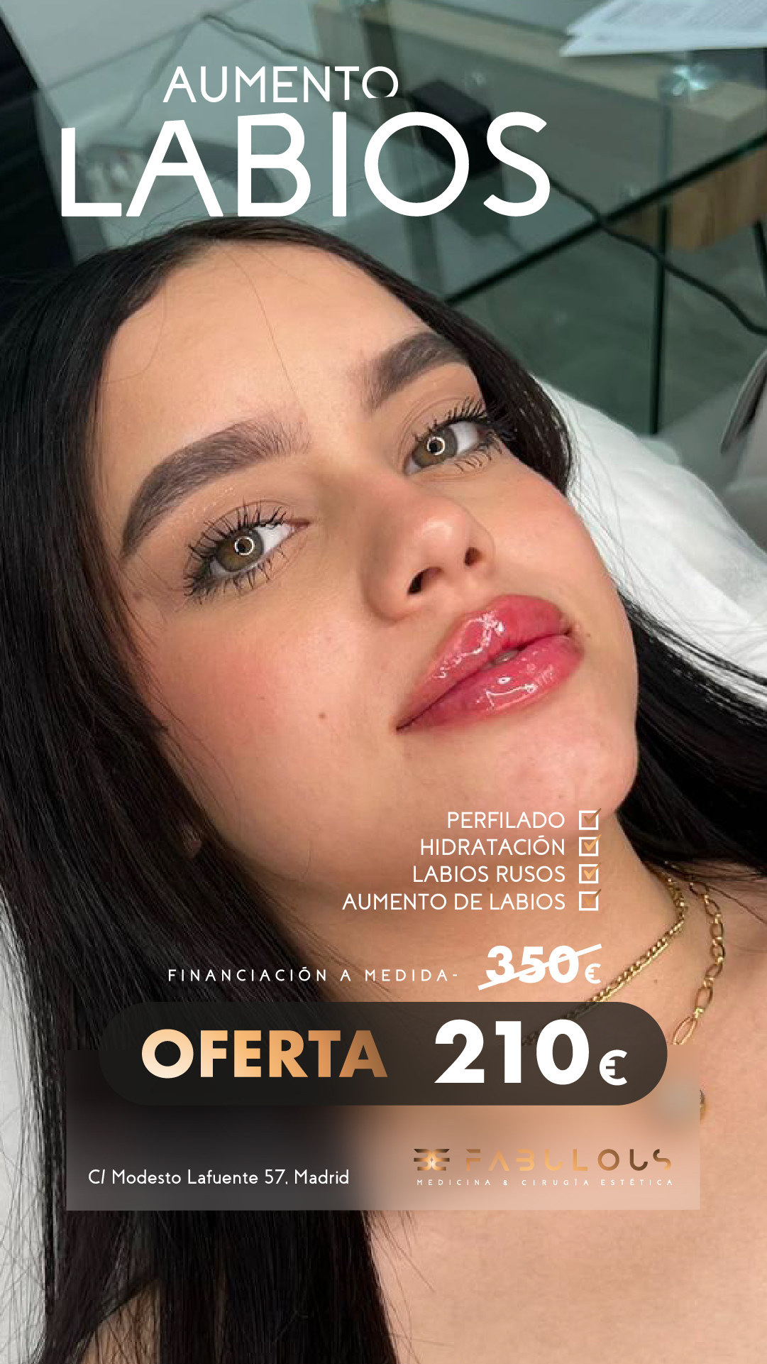 Clínica Be Fabulous Madrid Facebook ad from Jun 21, 2026
