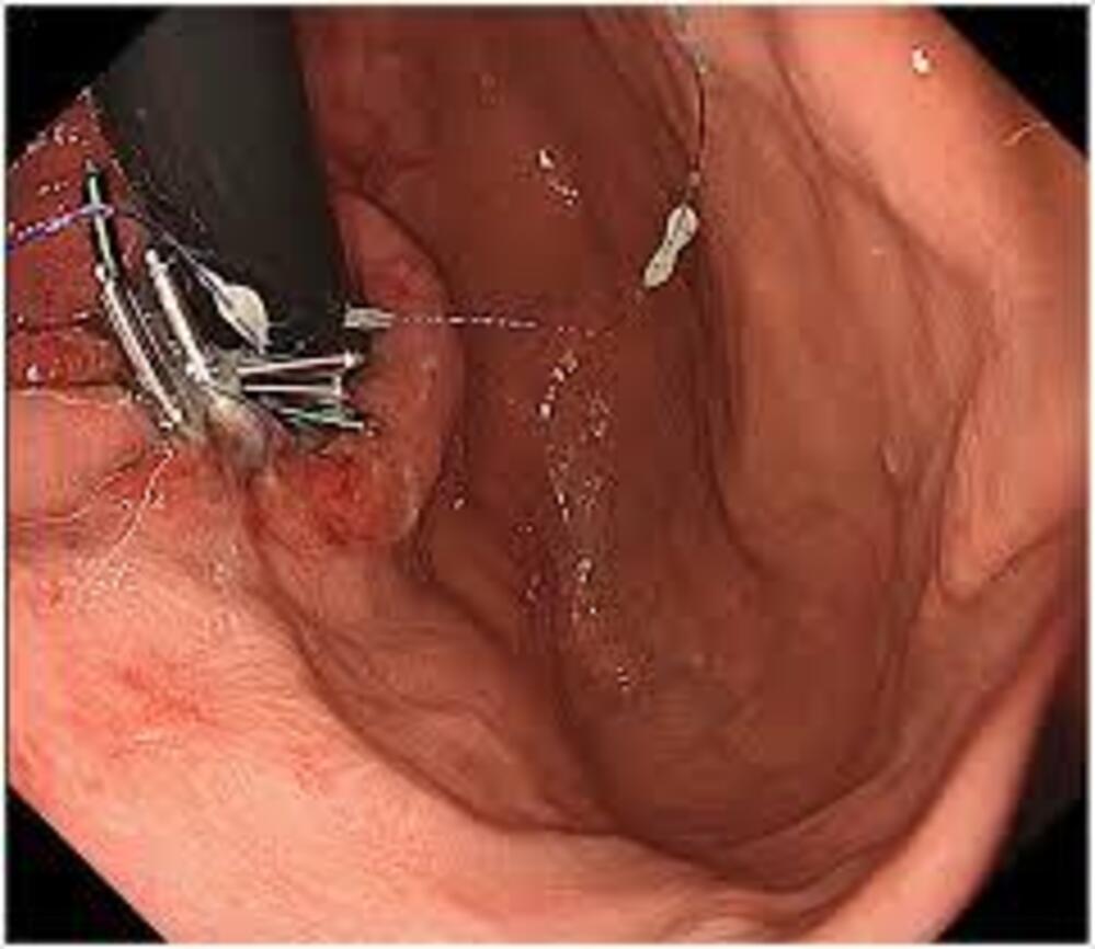 Dr. Patricia Moore PhD Facebook ad: They Treated Symptoms, Not Cause
