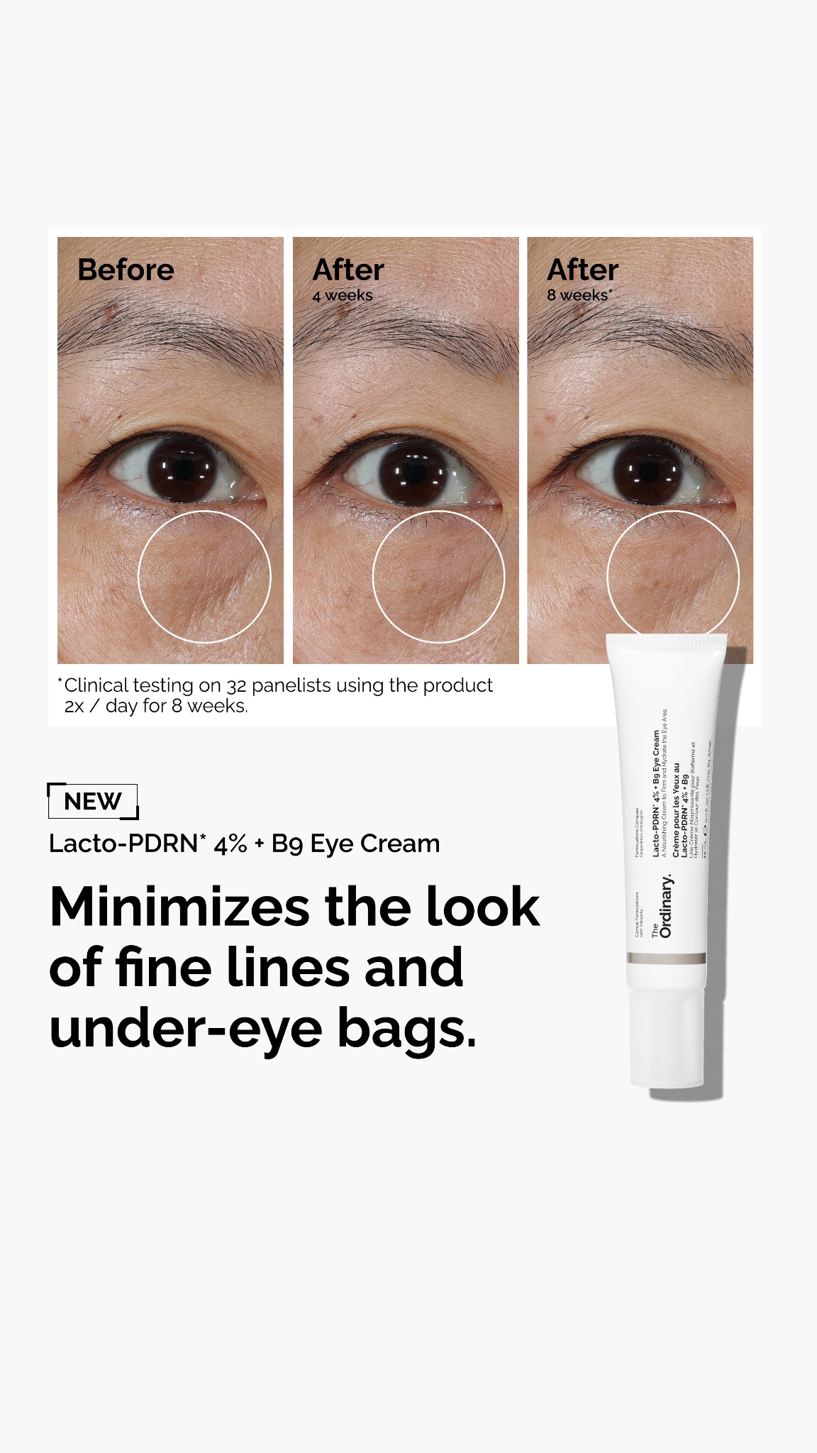 The Ordinary Facebook ad: Made to visibly repair eye skin.