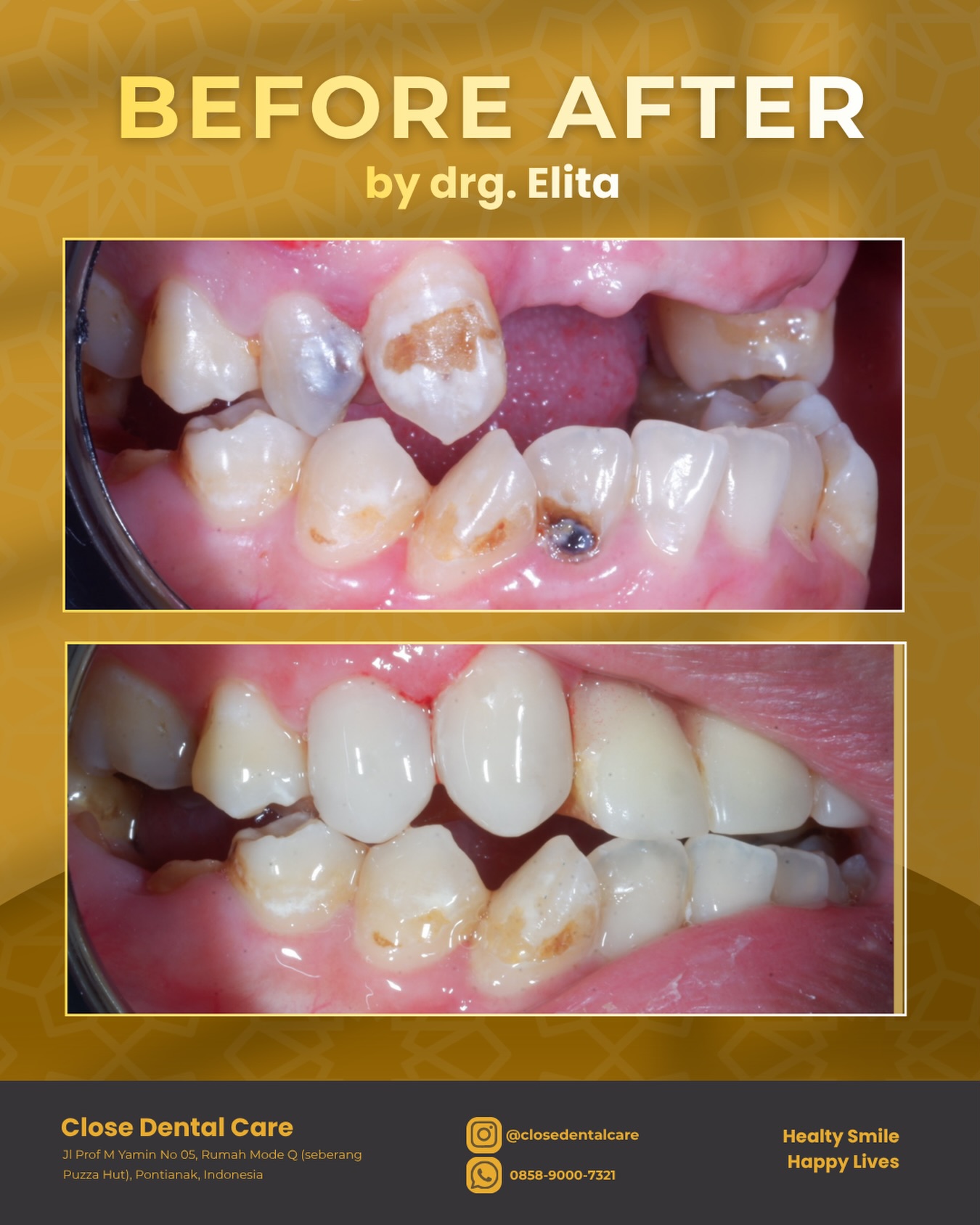 closedentalcare Facebook ad: Before & after Close Dental Care Karena senyum…