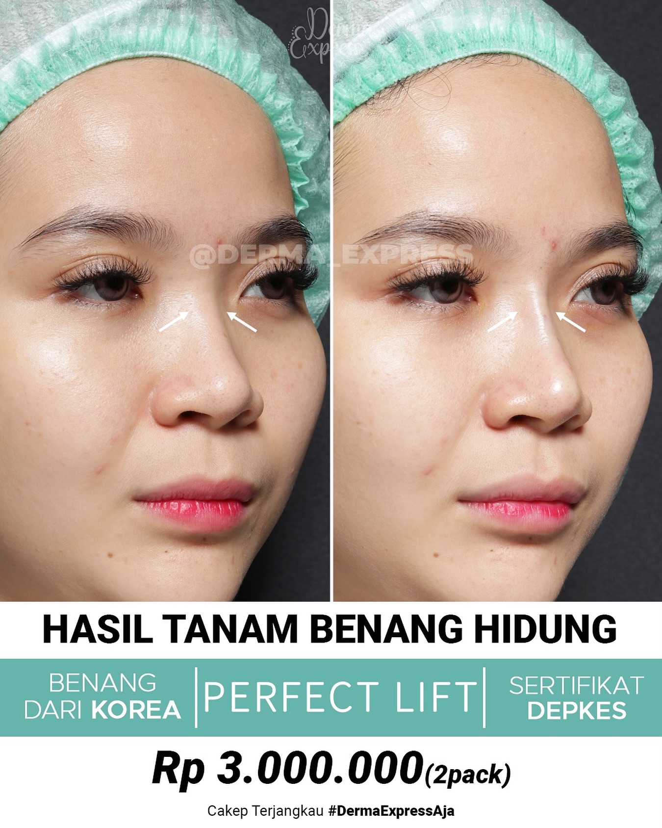 derma_express Facebook ad