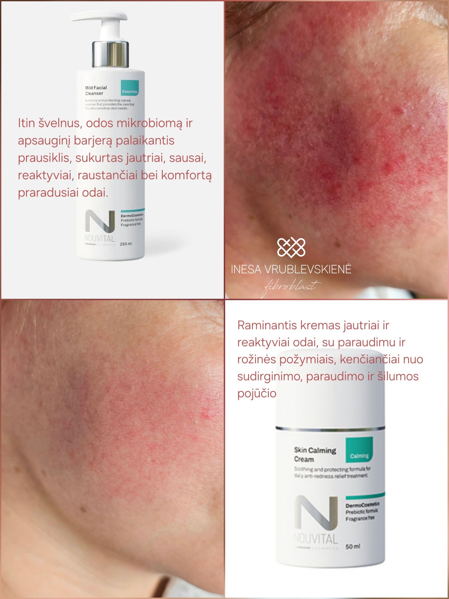 Inesa Vrublevskienė Fibroblast - Odos estetikė Facebook ad: Veido odos būklės gerinimui