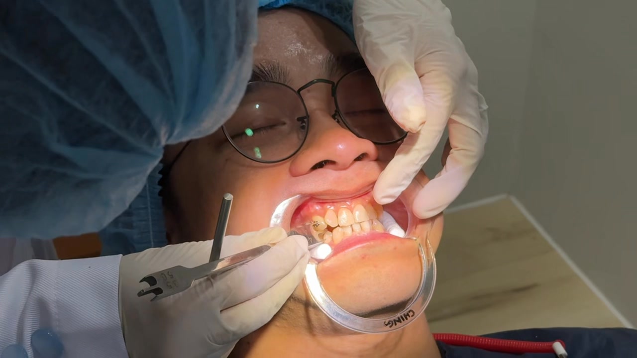 ProSmiles Dental Clinic Facebook ad: Invest in your smile now, and enjoy the…