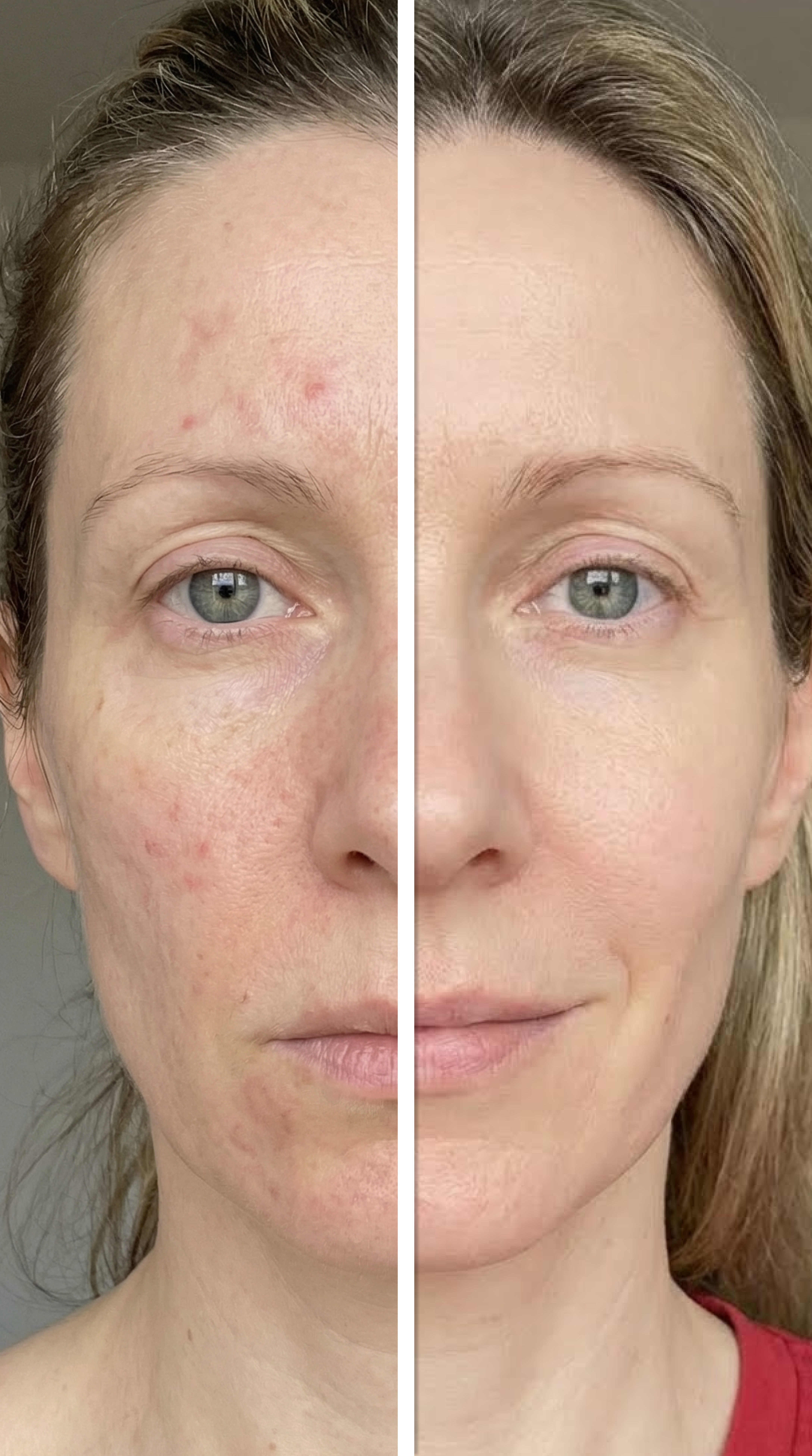 Epica Beauty Facebook ad: Start the journey to Younger look