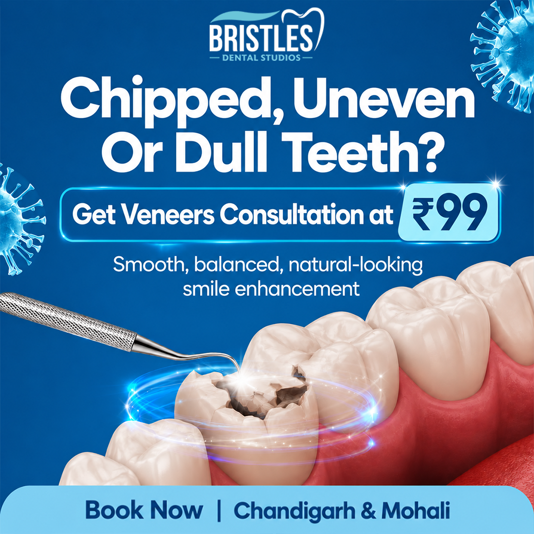 Bristles Dental Studios Facebook ad: Upgrade Your Smile With Veneers