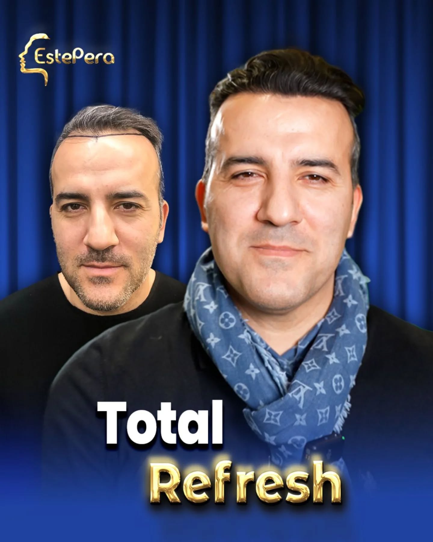 Estepera Clinic Facebook ad: Before / After