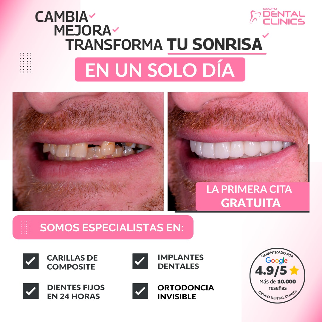 Grupo Dental Clinics Facebook ad