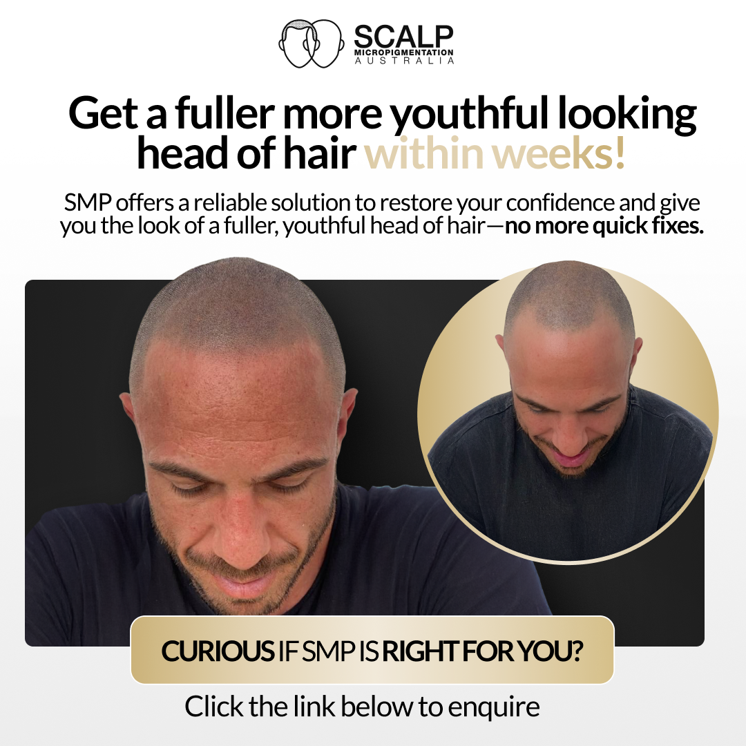 Scalp MicroPigmentation Australia Facebook ad