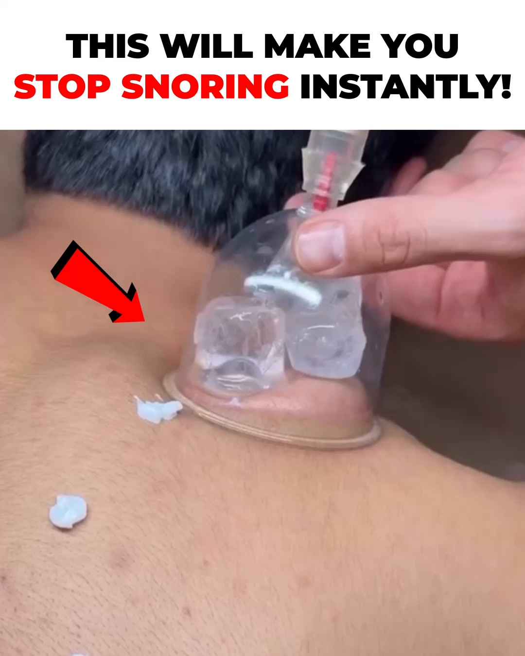 Honex Facebook ad: Fix Snoring & Sleepless Nights