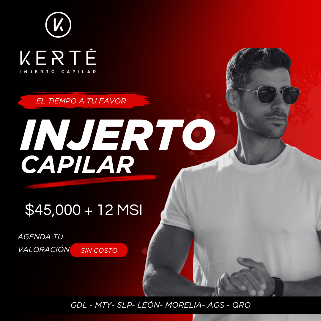 KERTÉ Facebook ad