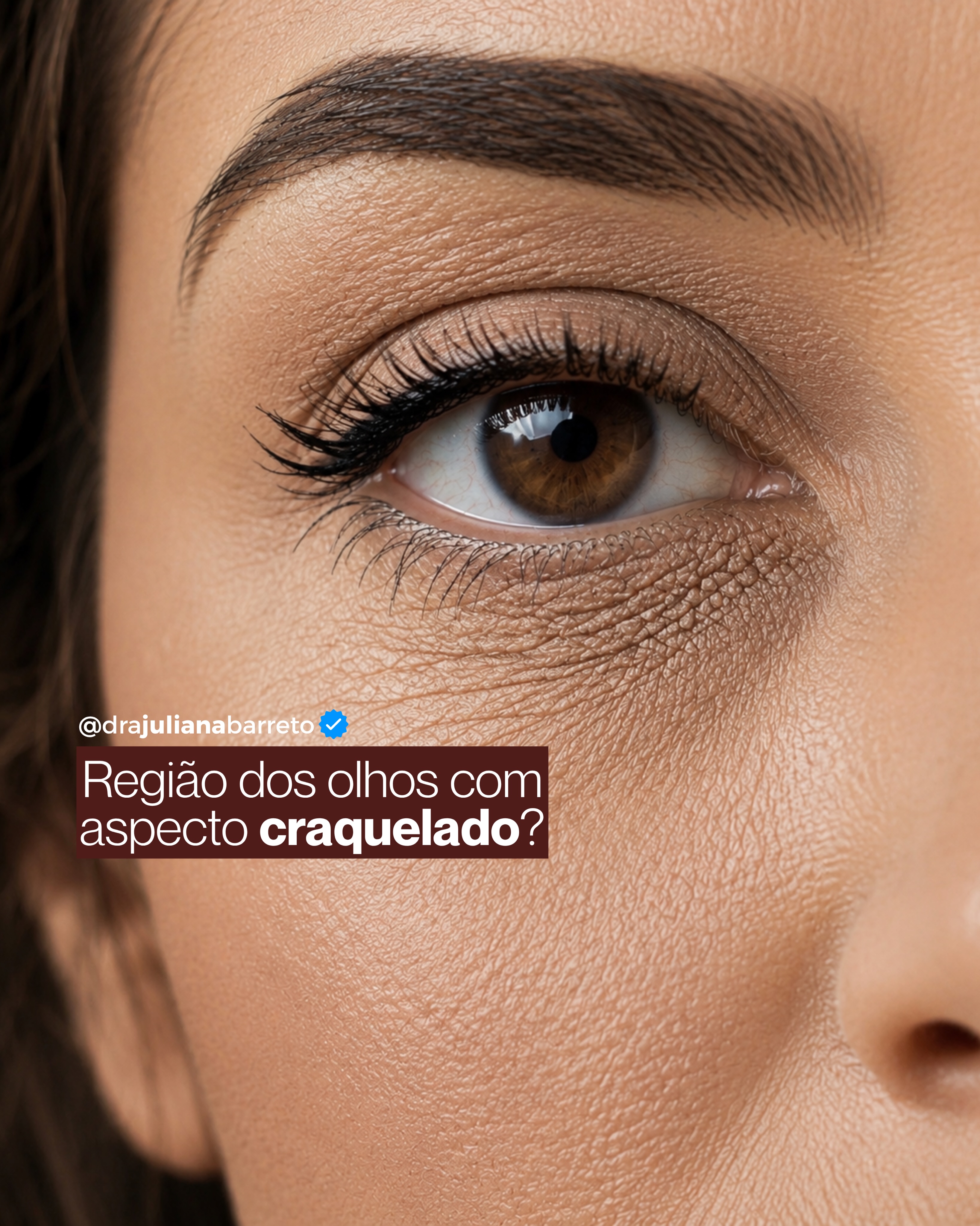 Dra Juliana Barreto Facebook ad: A pele ao redor dos olhos tem características…