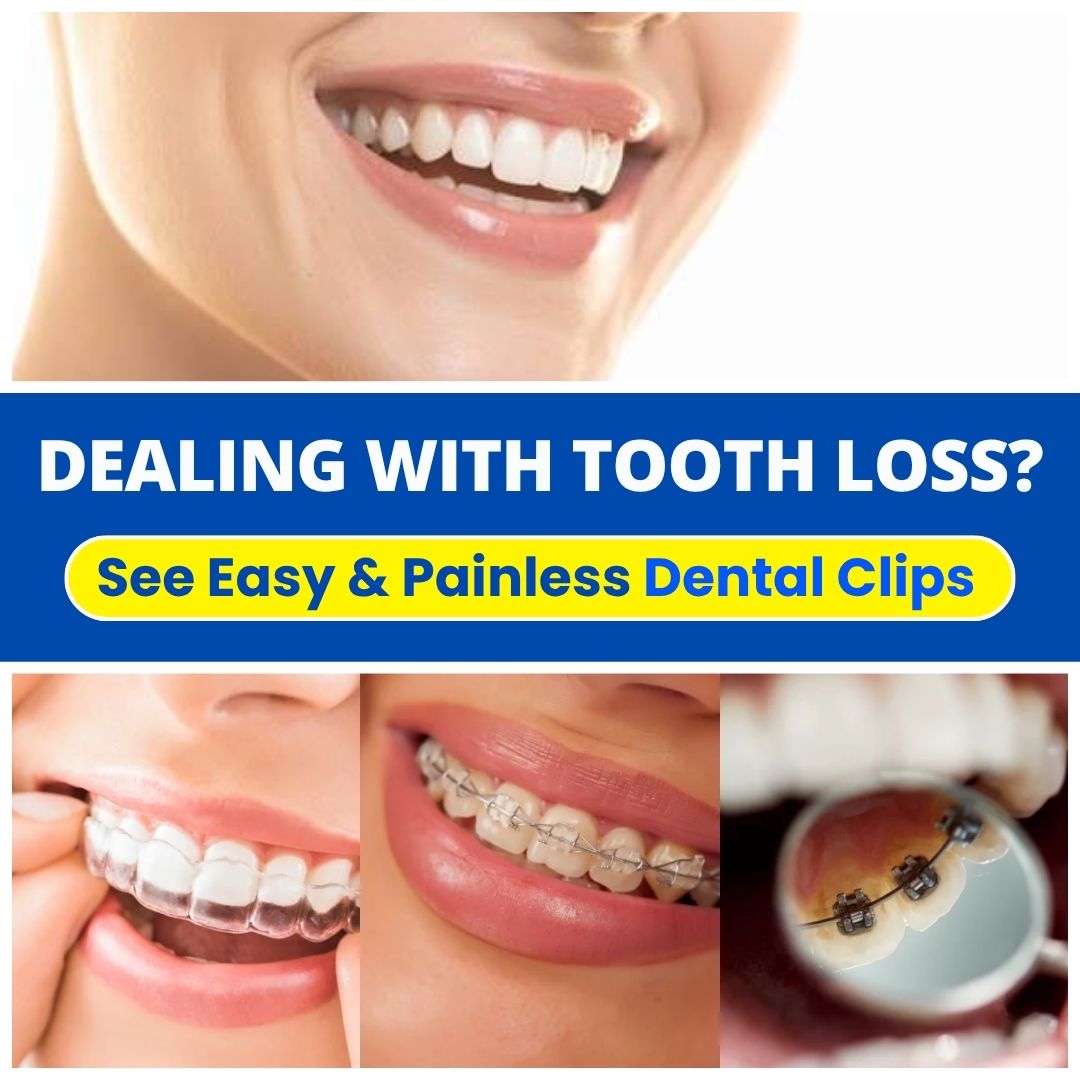 DemystDaily Facebook ad: Dental Clips for Teeth